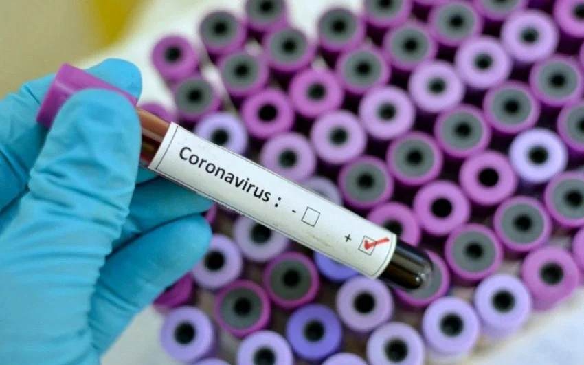 Depois de agrupar números represados de 2020, secretaria detalha dados de óbitos da Covid-19