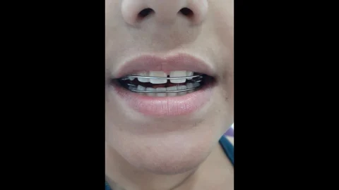 Dra Gabriella Pires | Cirurgiã Dentista em Barra Mansa em Barra Mansa – foto 6