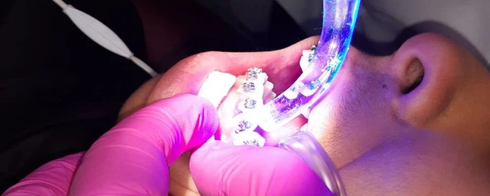 Dra Gabriella Pires | Cirurgiã Dentista em Barra Mansa